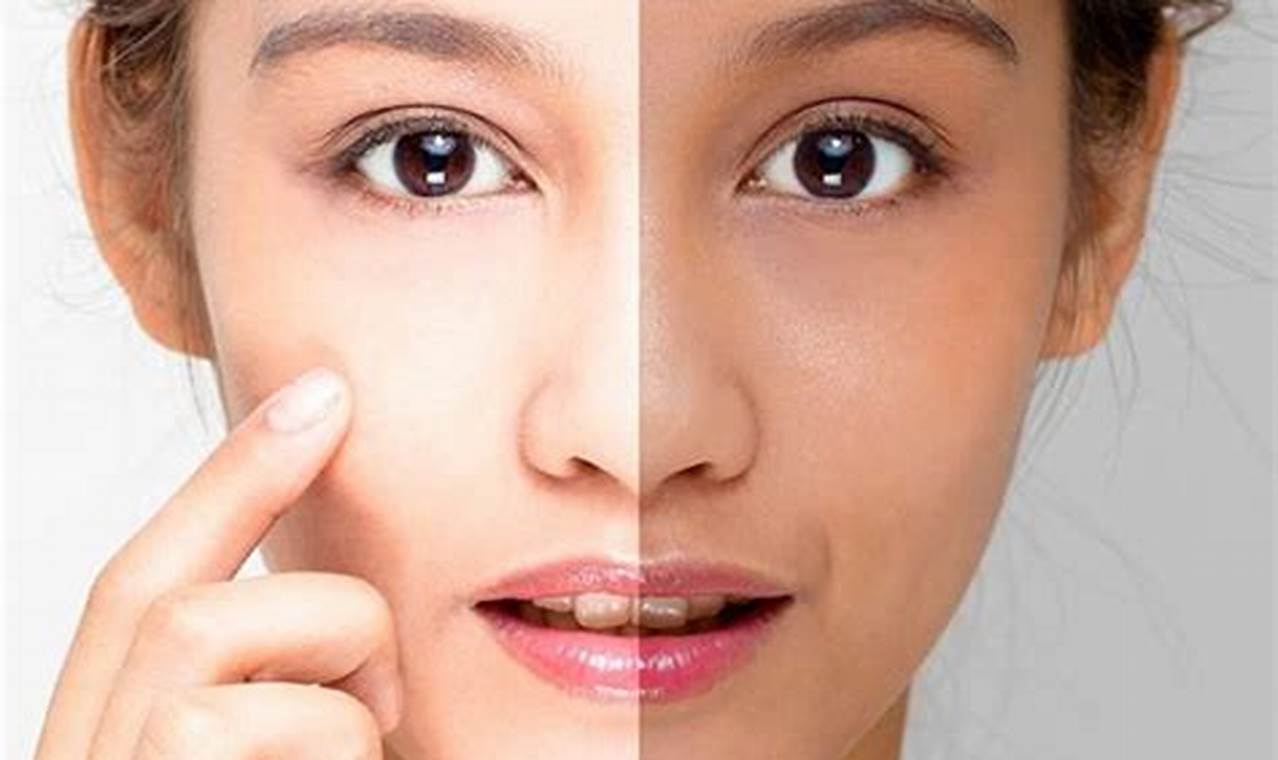 Cara Mengatasi Kulit Belang Di Wajah